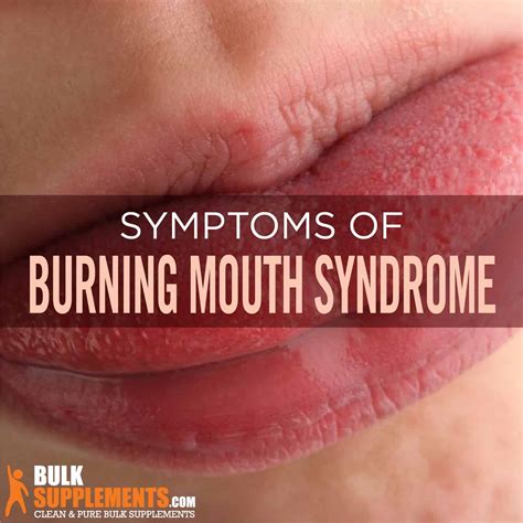 Burnin mouth - In Burning Mouth Syndrome, you have damaged nerves that are causing your pain. You want to regenerate new, healthy nerves that will then function properly. Estrogen helps with that regeneration. Testosterone is good for women and men. Testosterone is an important pain decreasing hormone. In addition to pain relief, both women and men have lots ...